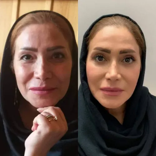 بلفارو