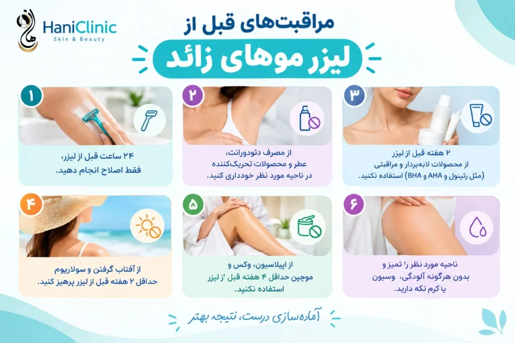 مراقبت های قبل از لیزر